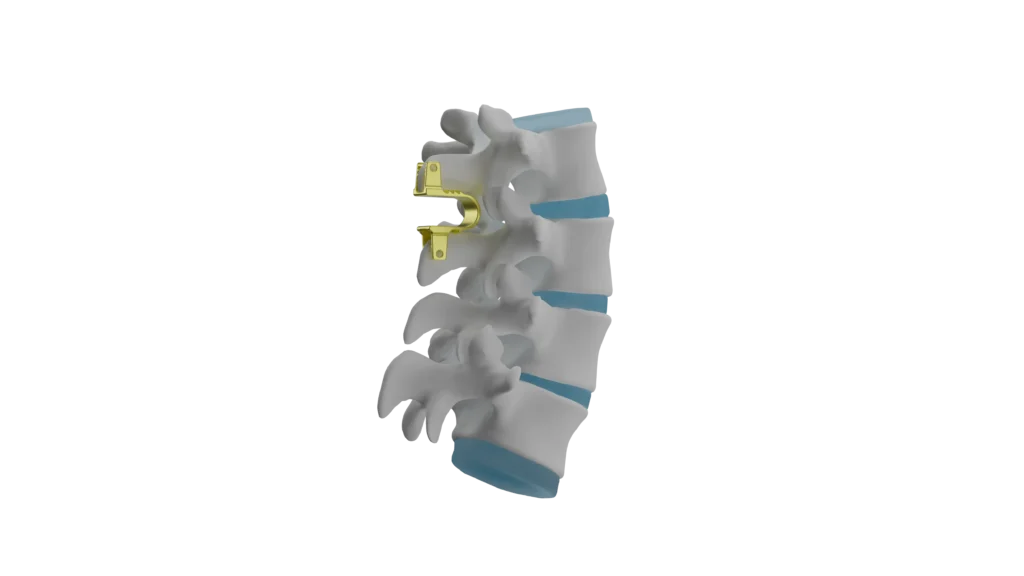 10 FLEXUS - Columna
