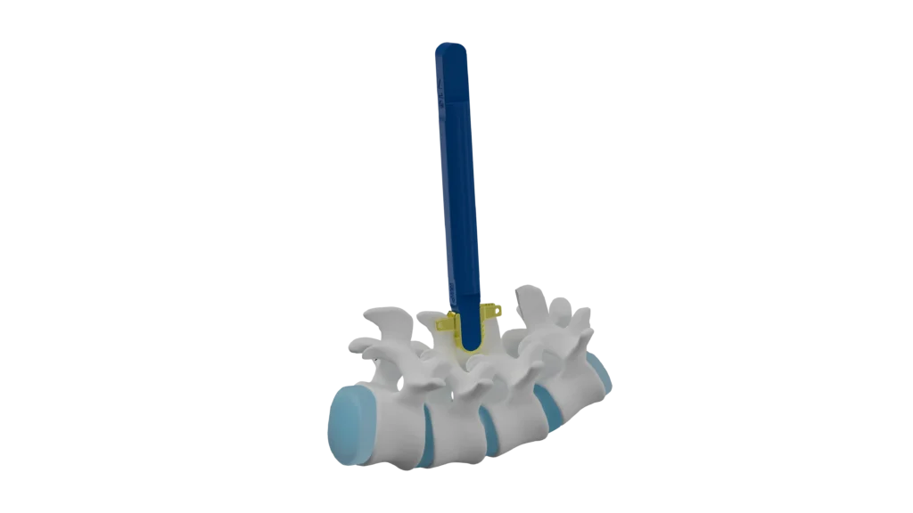 10 FLEXUS - Columna con Posicionador