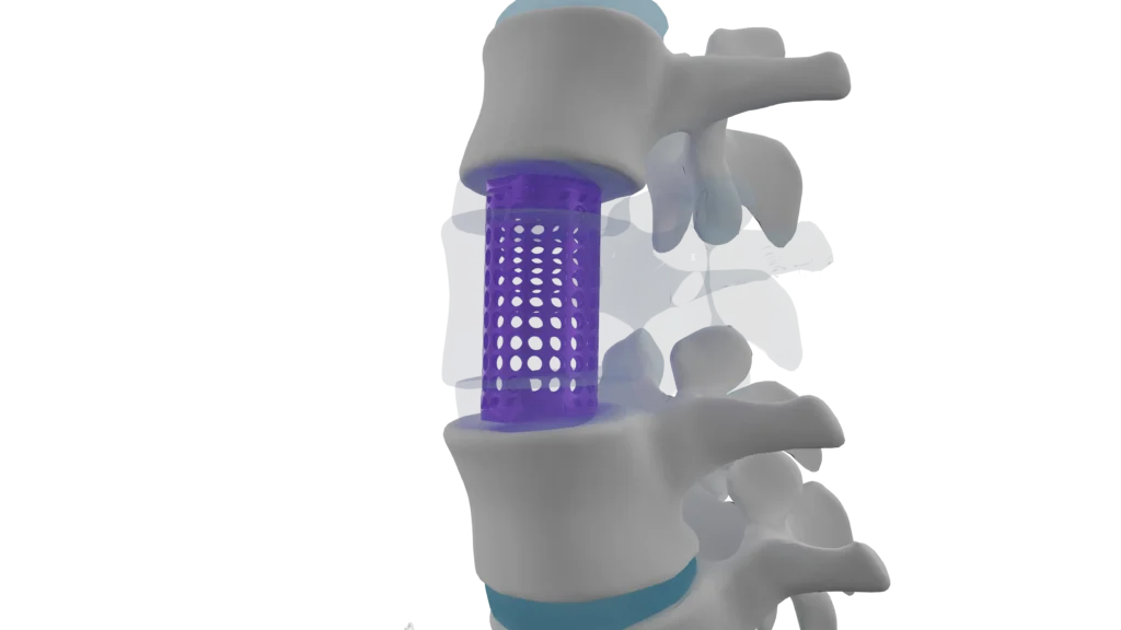 106 DIAMOND - Columna